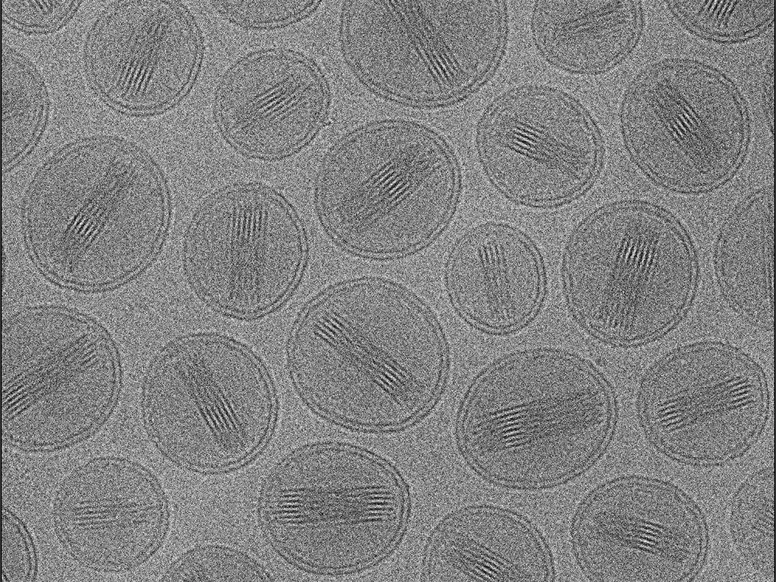 Liposomal Vitamin C Electron Microscopy (EM) imaging Liposomal Vitamin C Electron Microscopy (EM) imaging